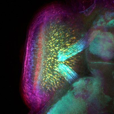 Dit microscoopfotootje van 0,3 millimeter kan de sleutel zijn tot het herstellen van blindheid