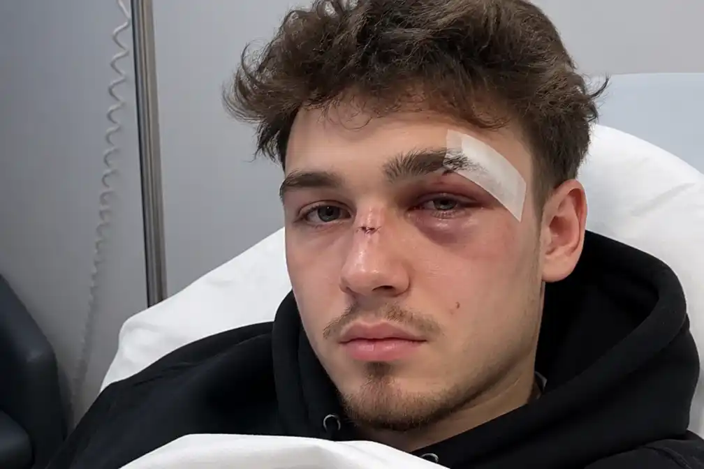 Influencer YoniHx gewond bij groepsaanval tijdens avondje uit in Antwerpen