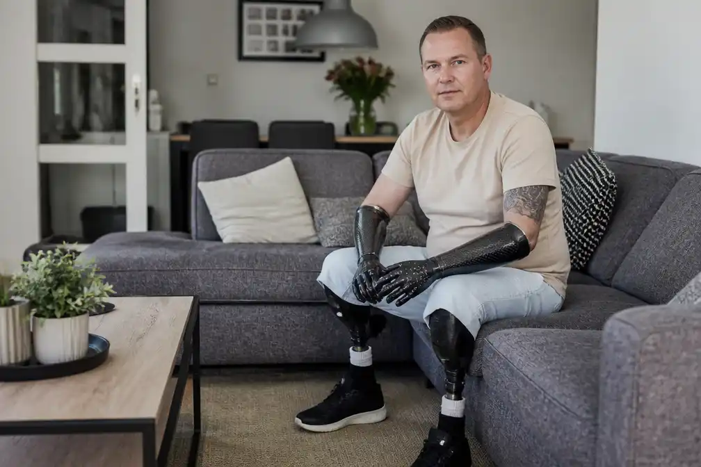 Man uit Soest verliest handen en voeten door pneumokokken, draagt nu bionische handen